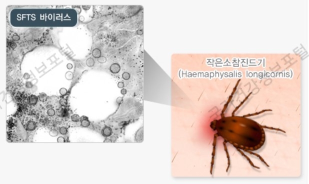국가건강정보 포털 제공