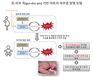 고려대 김희남 교수 연구팀 이번 연구에서 제시한 아토피 피부염 발병 모델